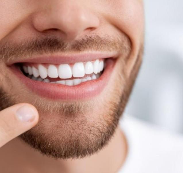 blanchiment dentaire